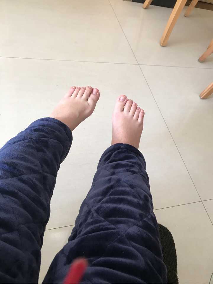脚踝骨折怎么做才能恢复的快 知乎 脚踝骨折怎么做才能恢复的快 知乎