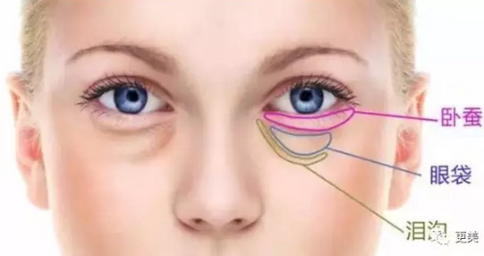 什么是 卧蚕 它跟眼袋有什么区别 知乎