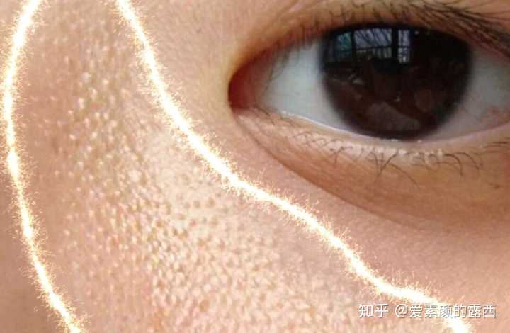 鸡皮肤最爱的食物(鸡皮肤最爱的食物有哪些)