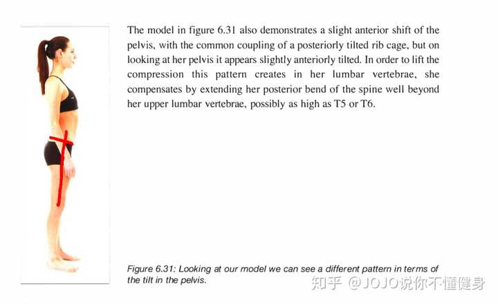 骨盆前倾有矫正成功的例子吗 知乎