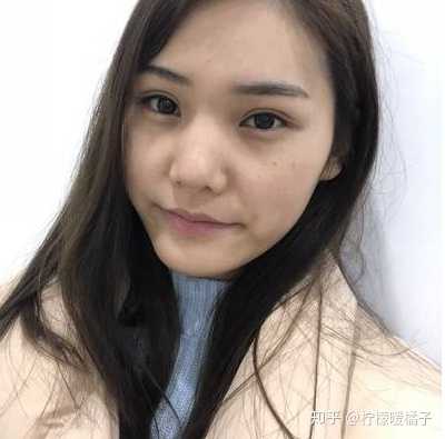 本人17岁 鼻头感觉特别大 有什么方法能改善一下吗 知乎