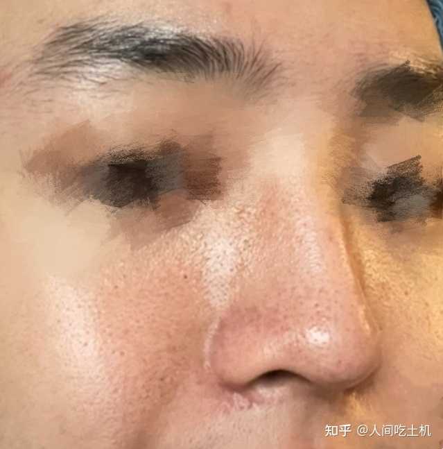 求推荐一套适合男生的护肤品，本人油皮，毛孔粗大，爱长痘，皮肤状态不好。谢谢各位护肤大佬？