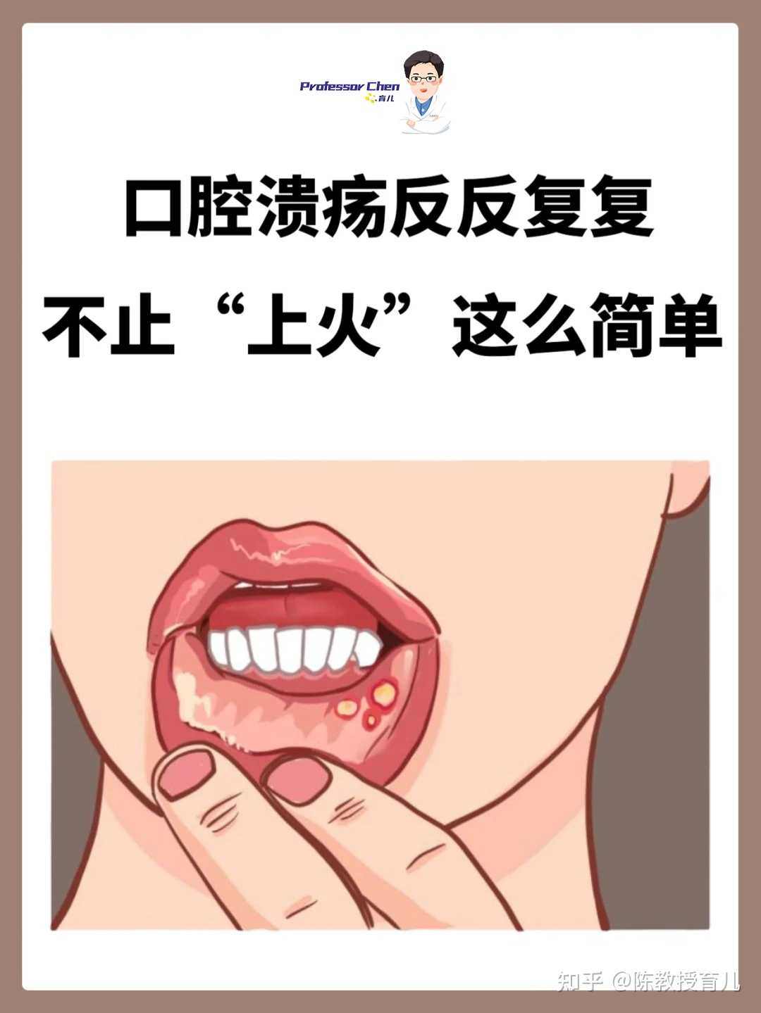 儿童口腔溃疡