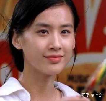 为什么非常多的明星都有斜视而不去治疗 知乎