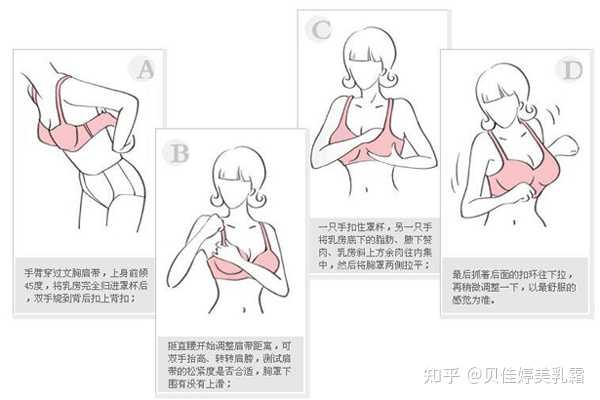 胸外扩可以改善吗？