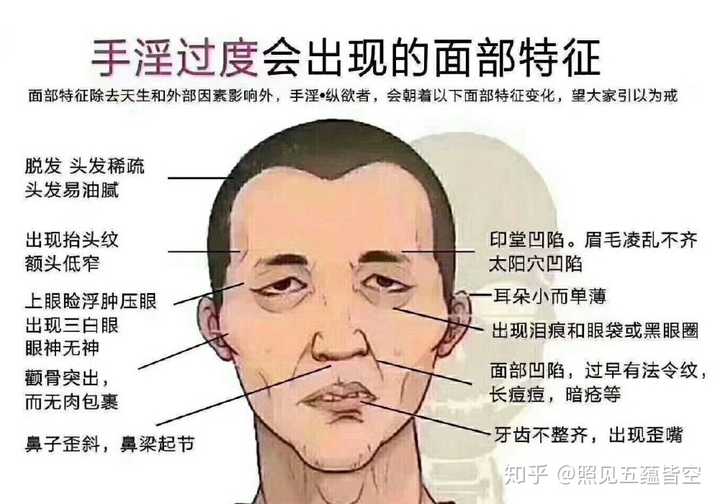 过度手淫会导致不育吗 答案是肯定的.