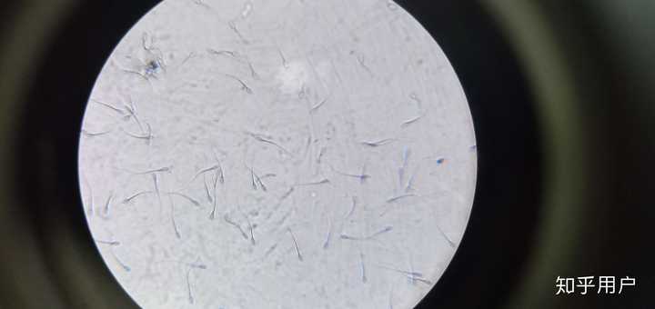 光学显微镜下,羊的精子.