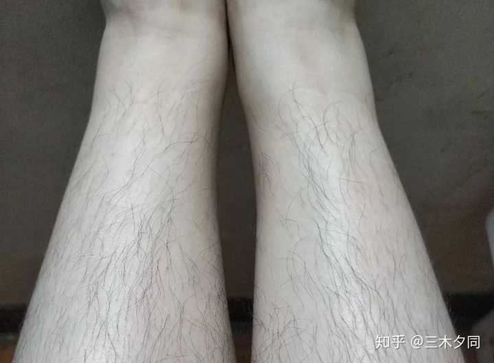 用什么来剃腿毛比较好?