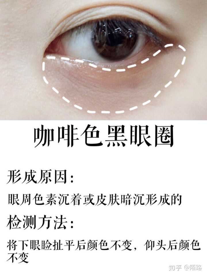 如何分辨并去除眼袋和黑眼圈 知乎 如何分辨并去除眼袋和黑眼圈 知乎