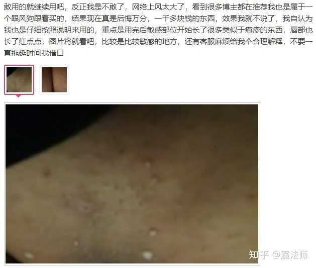 女生怎么给私处脱毛最安全 知乎 女生怎么给私处脱毛最安全 知乎