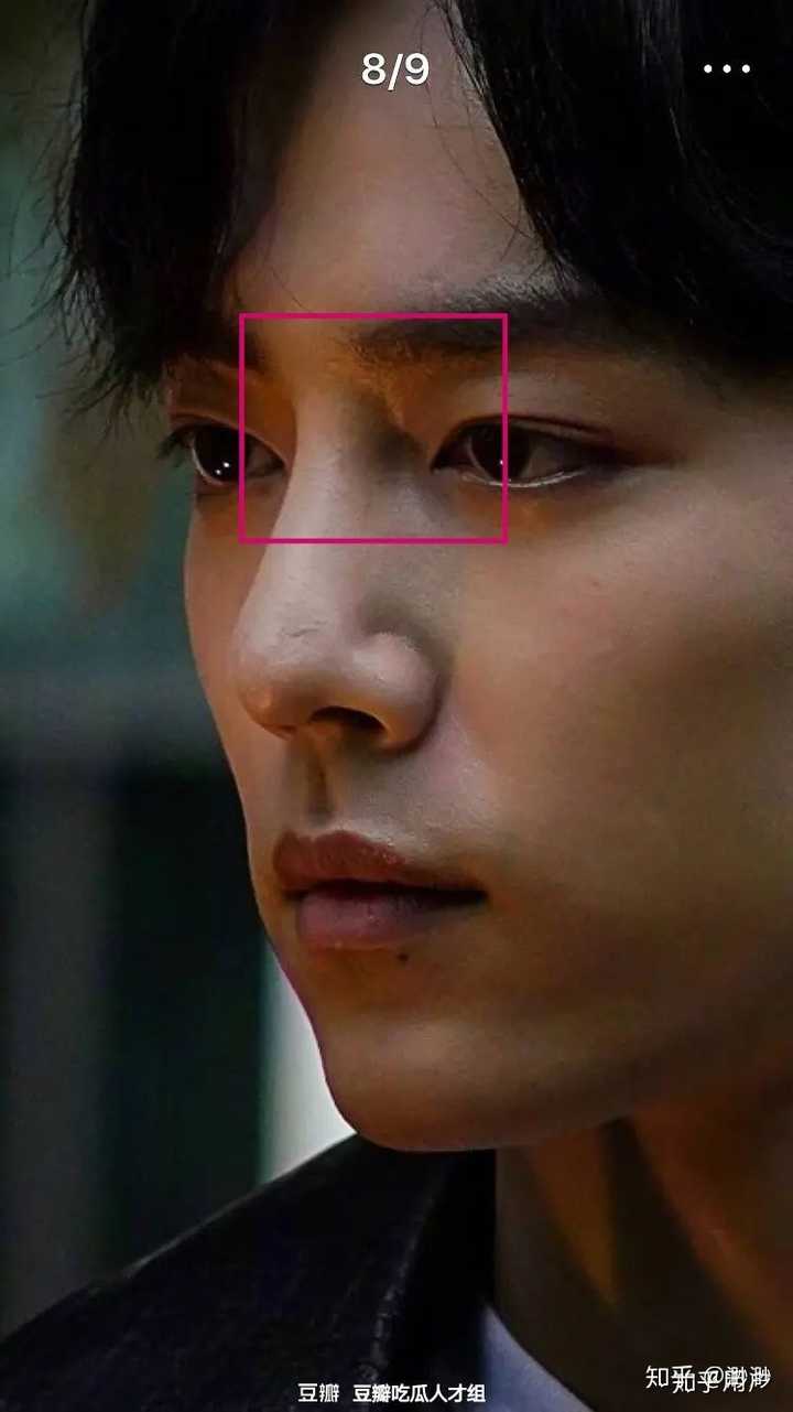 两张照片为同样的拍摄角度,我们比较一下二者的山根起点和鼻梁