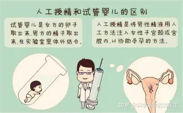 助孕方法人工图片