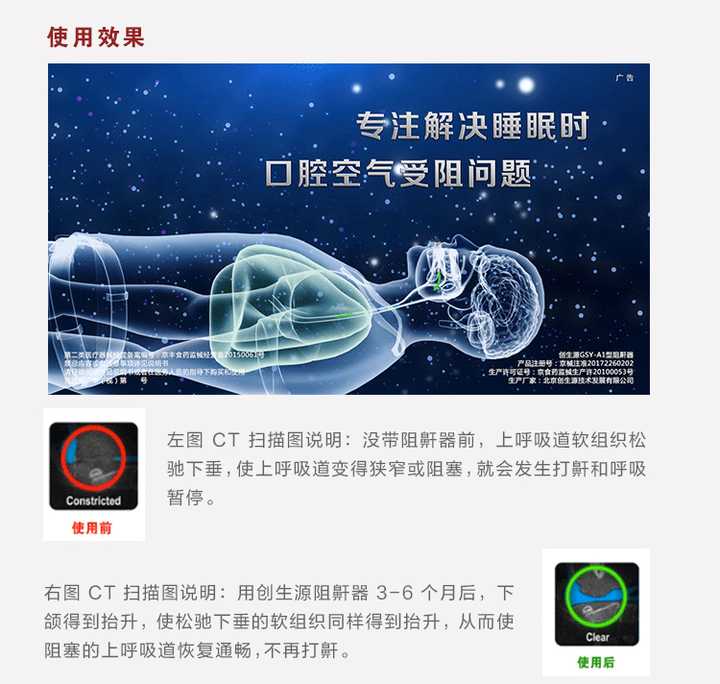 止鼾器是否真的管用 那一种类型的止鼾器管用呢 知乎 止鼾器是否真的管用 那一种类型的止鼾器管用呢 知乎