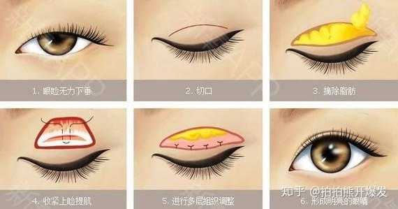 一双眼睛毁了一张脸是什么体验 知乎