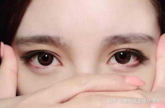 开外眼角与开内眼角有什么区别？大多数整容手术会选择哪一种？