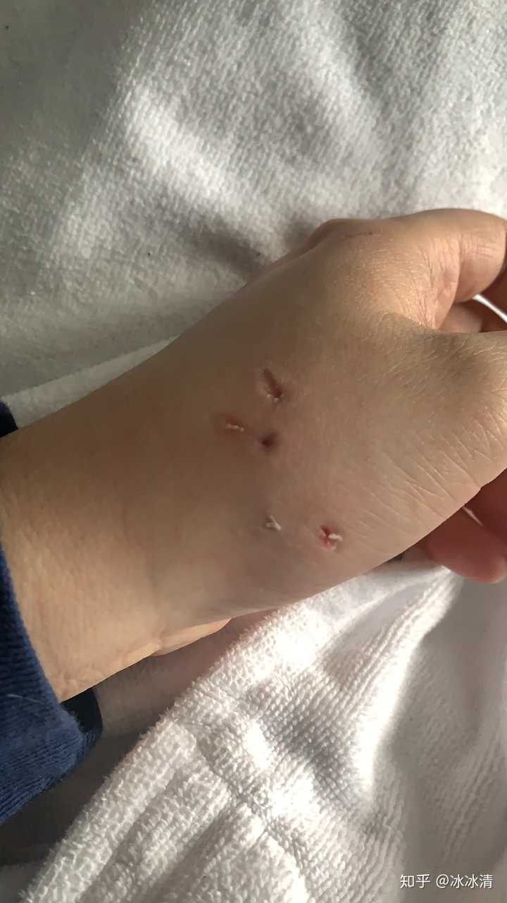 把手放进猫咪嘴里它会用力咬你吗.