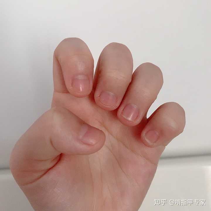 我还特别喜欢啃指甲,基本上指甲没有长过的时候