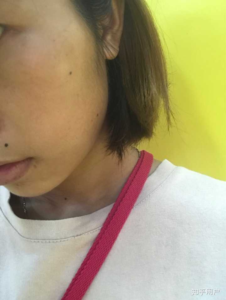 天生皮肤黑的人真的能通过后天保养或使用美白化妆品变白吗?