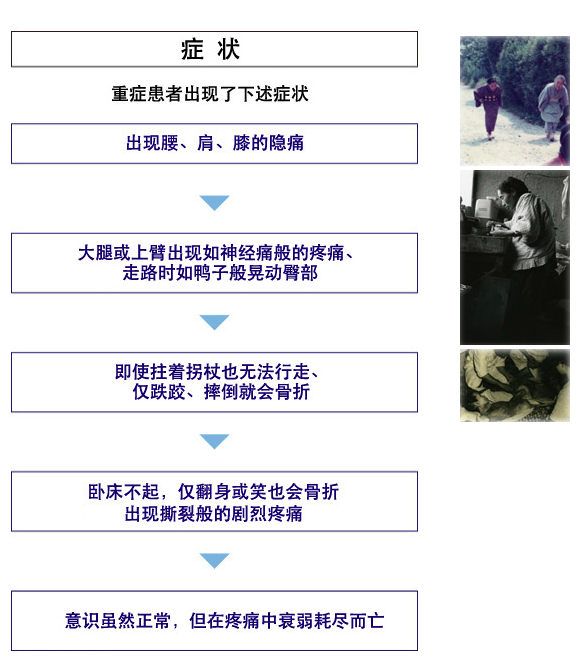 报道说湖南镉米中毒率高,尚未大范围爆发「痛痛病」,这是真的吗?