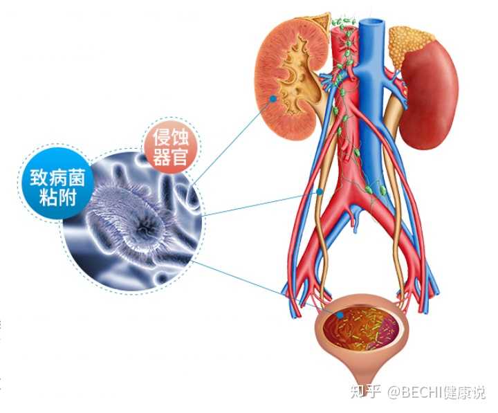 女性怎样避免经常性尿路感染 知乎