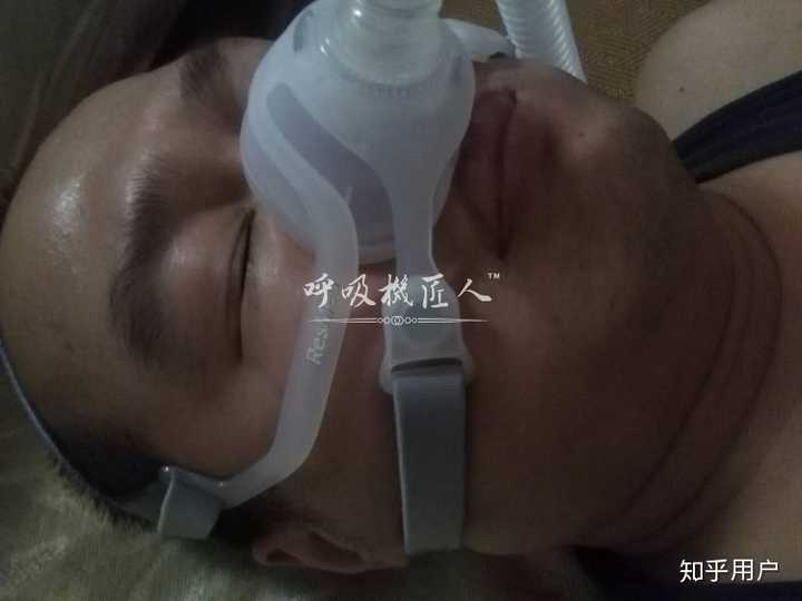 止鼾器是否真的管用 那一种类型的止鼾器管用呢 知乎 止鼾器是否真的管用 那一种类型的止鼾器管用呢 知乎