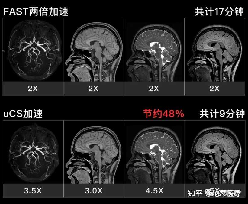 做头部核磁共振啥感觉 知乎