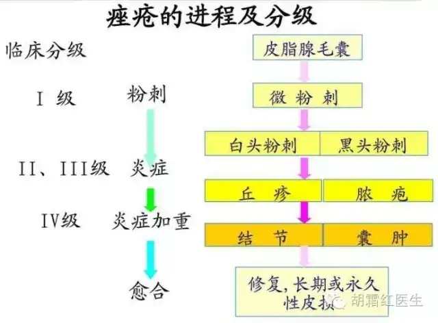 1,西医分类(1)寻常性痤疮,发生于面部,胸背部:1)皮脂溢出;2)粉刺.