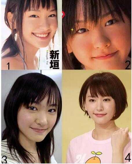 新垣結衣整形