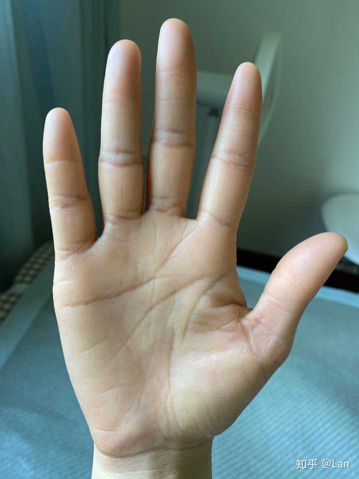 为什么我手背皮肤很细嫩很滑 而手心却干燥粗糙呢 知乎