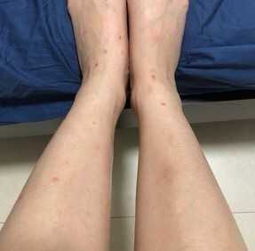 家里有跳蚤如何根除 知乎 家里有跳蚤如何根除 知乎