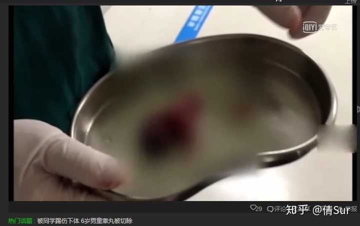 有哪些男性应该知道的男科常识 知乎 有哪些男性应该知道的男科常识 知乎