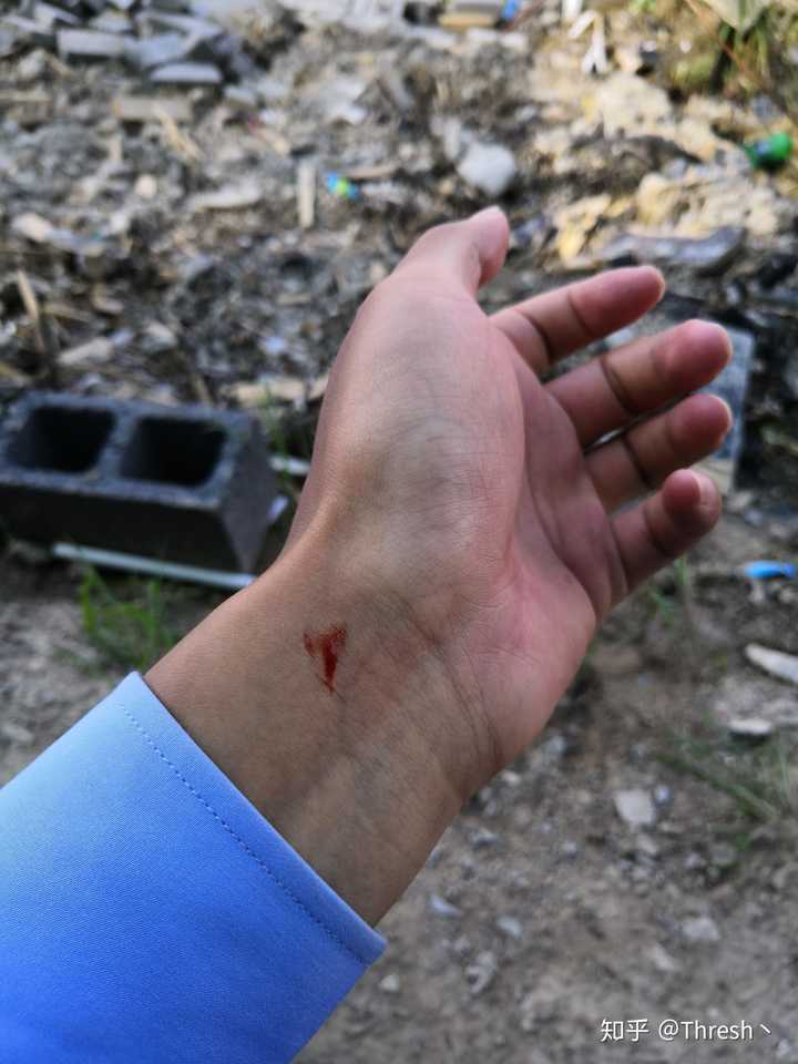 拍死一只蚊子,流出了自己的血