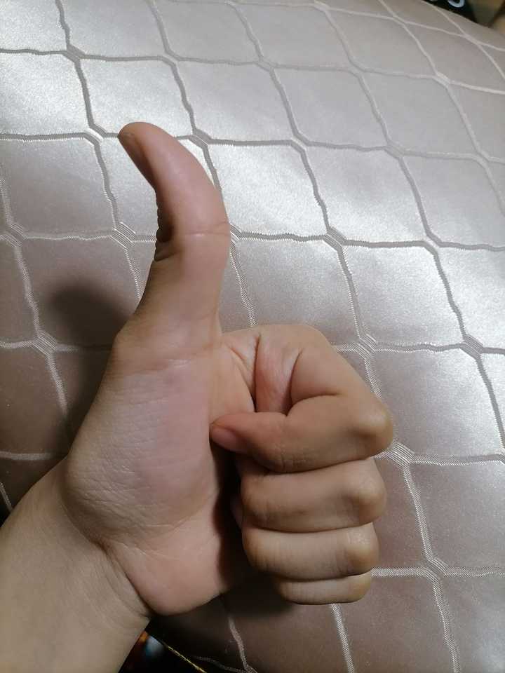 为什么有的人大拇指可以往后弯而有的人不行