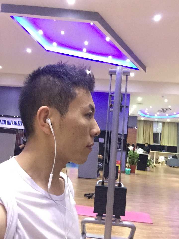 这个是下巴后缩吗