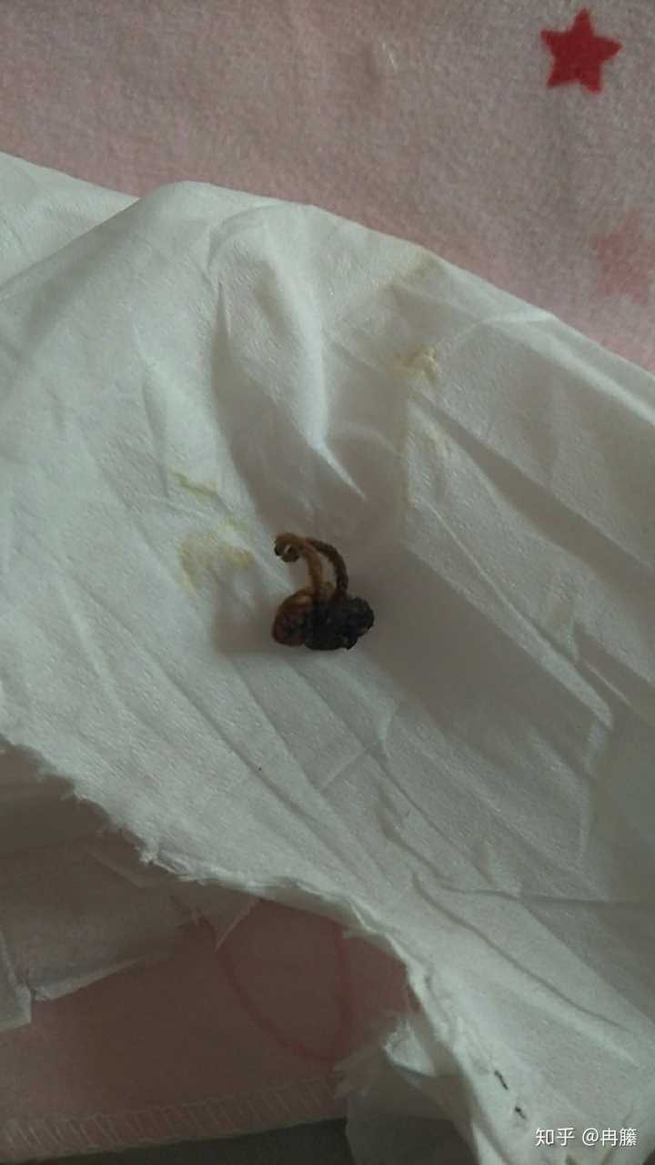 宝宝十二天了,但是他的脐带怎麼还没落?如果碰到宝宝会不会疼呢?