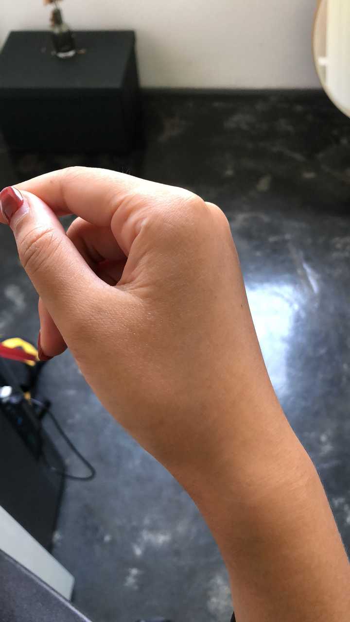 鸡皮肤被抠破了有疤怎么办(鸡皮肤被抠破了有疤怎么办图片)