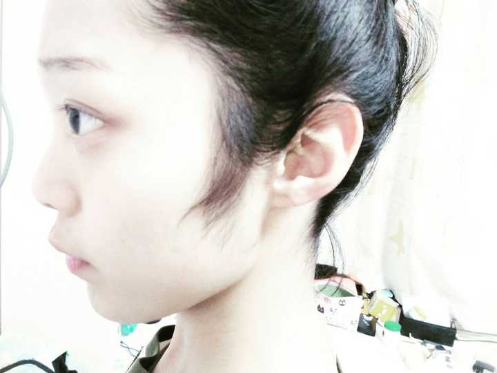 侧脸和50岁的大哥一样…而且没有耳垂