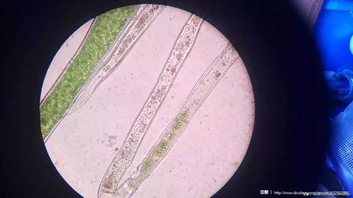 橘皮油细胞显微图图片