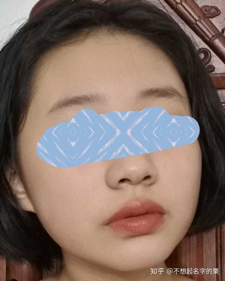 眼睛不好看毁了整张脸的情况存在么?