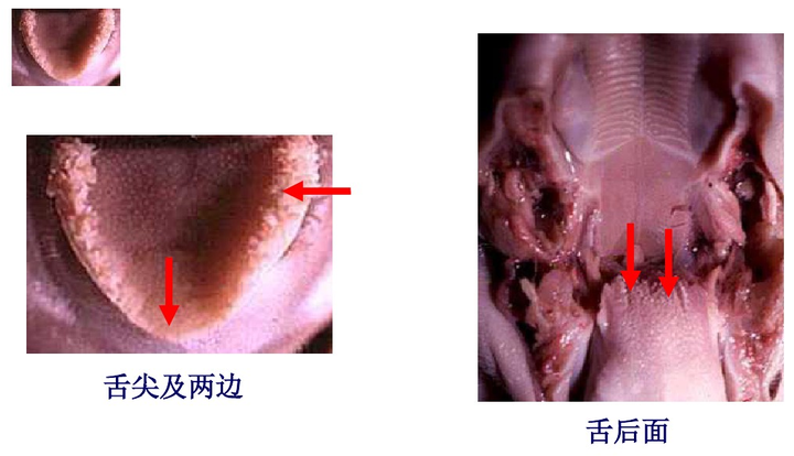 舌乳头 两侧图片