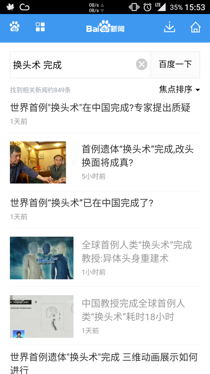 如何看待世界首例换头 尸体头部移植 手术号称实验成功 知乎 如何看待世界首例换头 尸体头部移植 手术号称实验成功 知乎