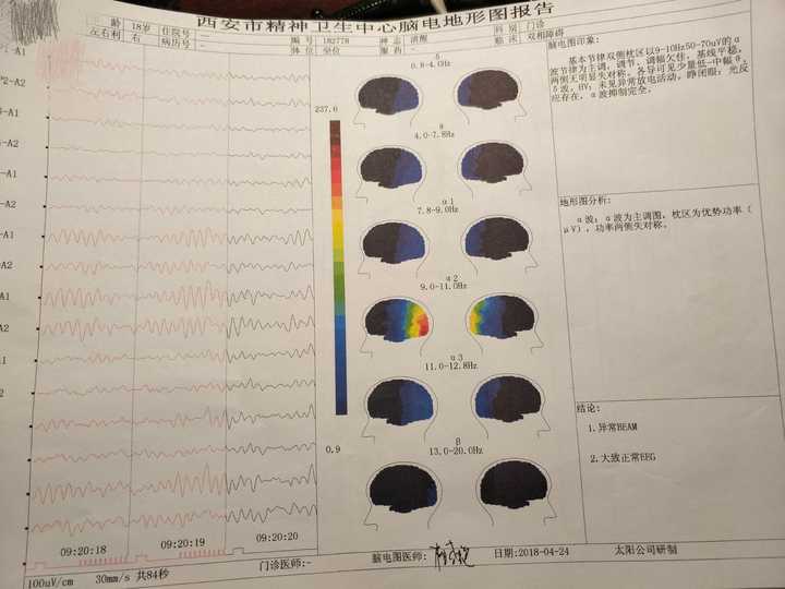 正常人有没有办法伪装成精神病 并且被成功确诊 知乎 正常人有没有办法伪装成精神病 并且被成功确诊 知乎
