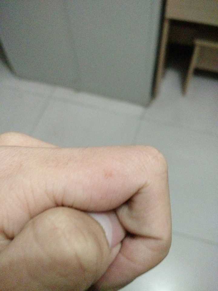 手背毛孔粗大凑合看吧.