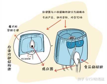 长期卧床的老人需要哪些护理 知乎 长期卧床的老人需要哪些护理 知乎