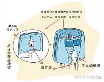 长期卧床的老人需要哪些护理 知乎