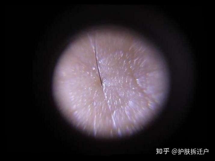 正常皮肤显微镜下图片图片