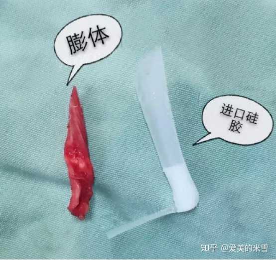 膨体结构图片