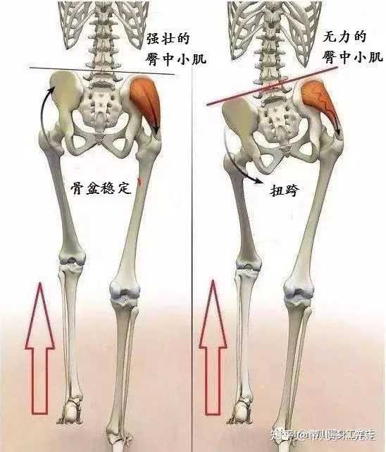 胯骨一高一低图片图片