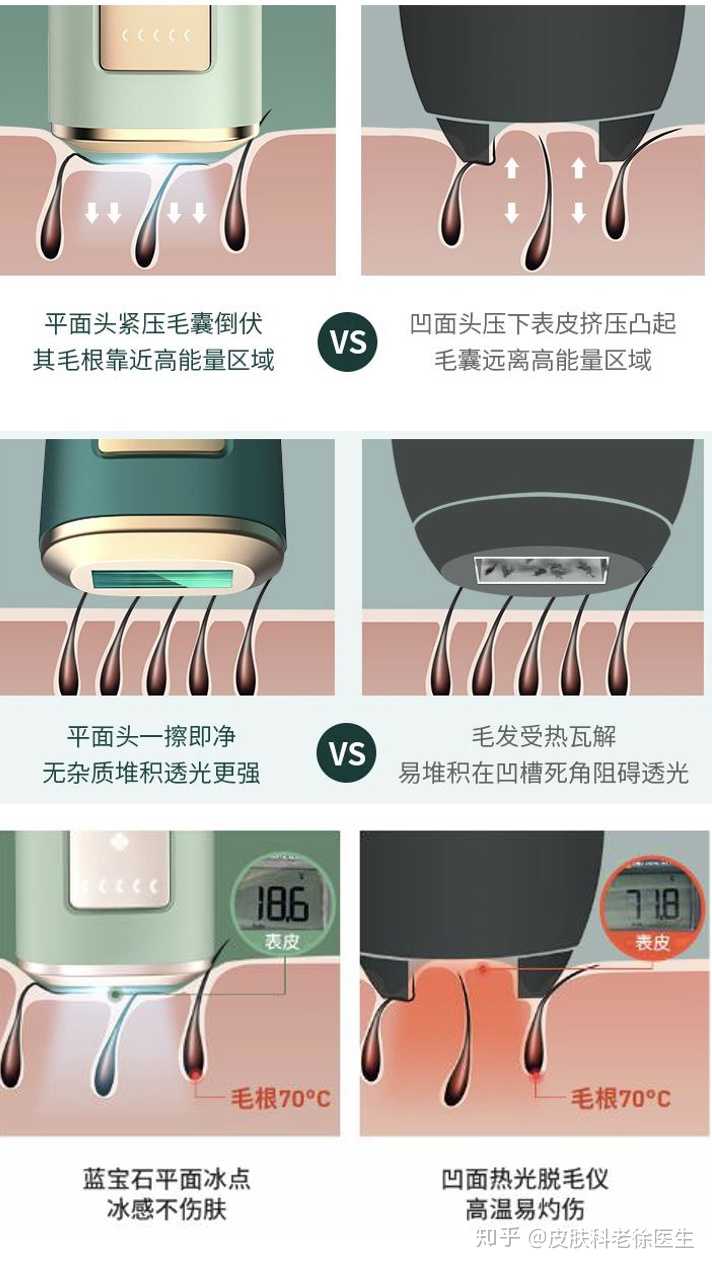 激光脱毛真的对皮肤无伤害吗 知乎