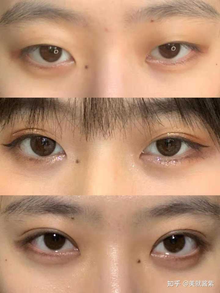 贵州哪里做双眼皮最好 知乎